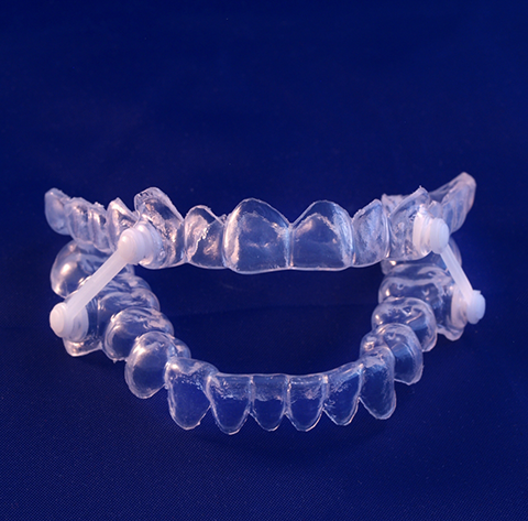 Clear oral appliance for sleep apnea treatment in North Olmsted