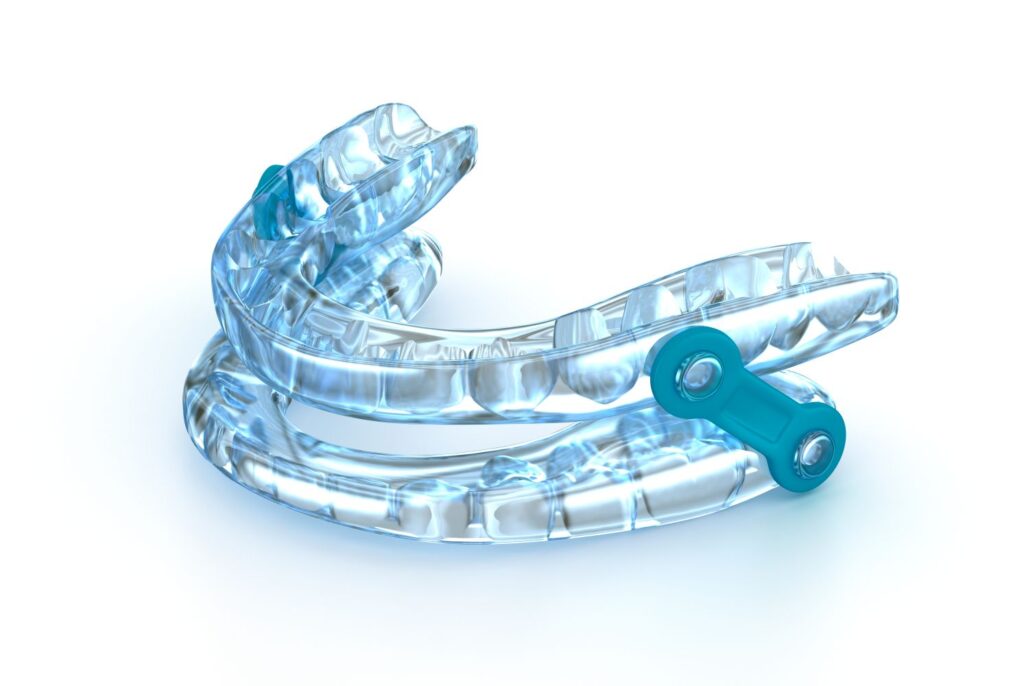 An oral appliance for sleep apnea
